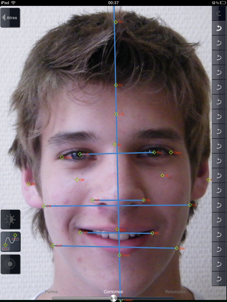 Изучение лица. Словесный портрет криминалистической габитоскопии. Идеальный цвет лица. Лицо в целом. Лицо изучающее систему.